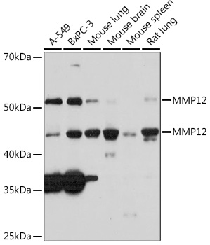 Western blot analysis of various lysates using MMP12 pAb at 1:1000 dilution.|Secondary antibody: HRP-conjugated Goat anti-Rabbit IgG (H+L) at 1:10000 dilution.|Lysates/proteins: 25μg per lane.|Blocking buffer: 3% nonfat dry milk in TBST.|Detection: ECL Enhanced Kit.|Exposure time: 3min.