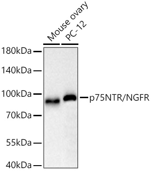 Western blot analysis of various lysates using p75NTR/NGFR Rabbit mAb at 1:4000 dilution incubated overnight at 4℃.|Secondary antibody: HRP-conjugated Goat anti-Rabbit IgG (H+L) at 1:10000 dilution.|Lysates/proteins: 25 μg per lane.|Blocking buffer: 3% nonfat dry milk in TBST.|Detection: ECL Basic Kit.|Exposure time: 30s.