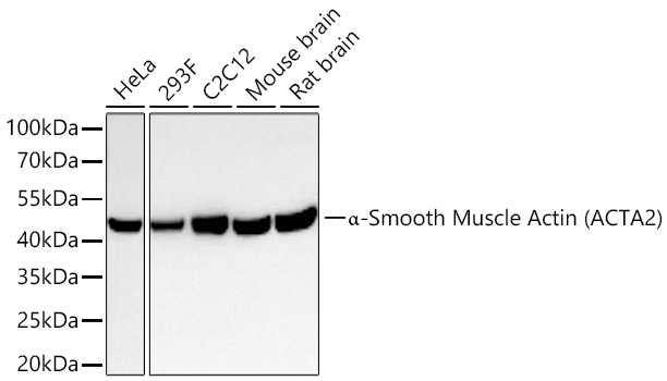Western blot analysis of various lysates using α-Smooth Muscle Actin Rabbit mAb at 1:13000 dilution incubated overnight at 4℃.|Secondary antibody: HRP-conjugated Goat anti-Rabbit IgG (H+L) at 1:10000 dilution.|Lysates/proteins: 25 μg per lane.|Blocking buffer: 3% nonfat dry milk in TBST.|Detection: ECL Basic Kit.|Exposure time: 20s.