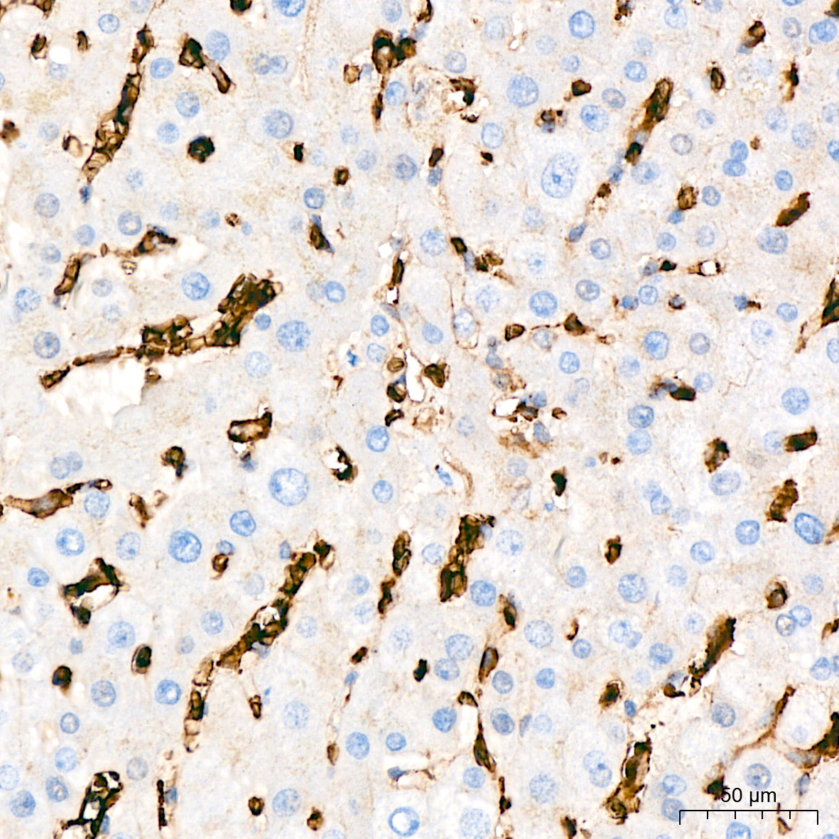 Immunohistochemistry analysis of paraffin-embedded Human liver tissue using GLUT1/SLC2A1 Rabbit mAb at a dilution of 1:800 (40x lens). High pressure antigen retrieval performed with 0.01M Tris-EDTA Buffer (pH 9.0) prior to IHC staining.