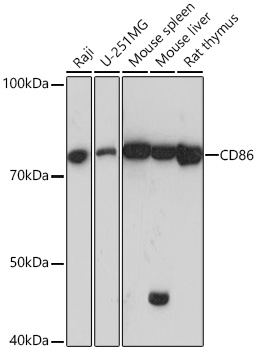 Western blot analysis of various lysates using CD86 Rabbit mAb at 1:1000 dilution.|Secondary antibody: HRP-conjugated Goat anti-Rabbit IgG (H+L) at 1:10000 dilution.|Lysates/proteins: 25μg per lane.|Blocking buffer: 3% nonfat dry milk in TBST.|Detection: ECL Basic Kit.|Exposure time: 5s.
