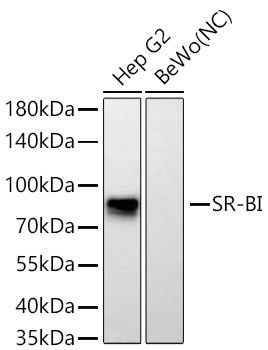 Western blot analysis of various lysates using SR-BI Rabbit mAb at 1:2000 dilution incubated overnight at 4℃.|Secondary antibody: HRP-conjugated Goat anti-Rabbit IgG (H+L) at 1:10000 dilution.|Lysates/proteins: 25 μg per lane.|Blocking buffer: 3% nonfat dry milk in TBST.|Detection: ECL Basic Kit.|Negative control (NC): BeWo|Exposure time: 45s.