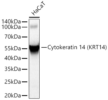 Western blot analysis of lysates from HaCaT cells using Cytokeratin 14 (KRT14) Rabbit mAb at 1:5000 dilution incubated at room temperature for 1.5 hours.|Secondary antibody: HRP-conjugated Goat anti-Rabbit IgG (H+L) at 1:10000 dilution.|Lysates/proteins: 25 μg per lane.|Blocking buffer: 3% nonfat dry milk in TBST.|Detection: ECL Basic Kit.|Exposure time: 20s.