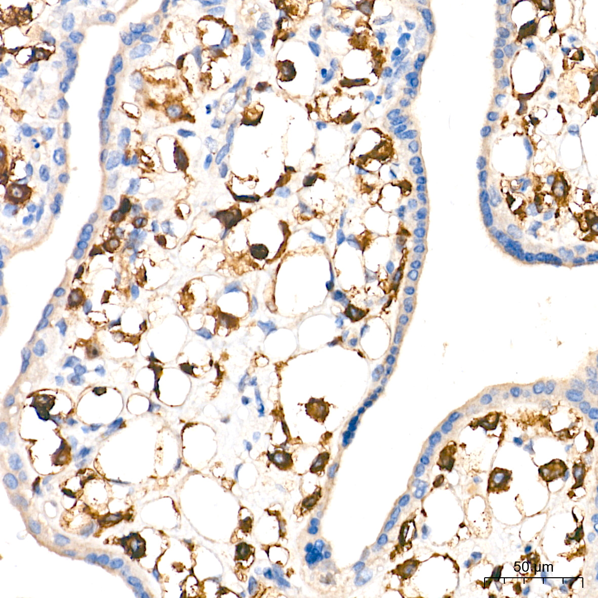 Immunohistochemistry analysis of paraffin-embedded Human placenta tissue using CD14 Rabbit mAb at a dilution of 1:2000 (40x lens). High pressure antigen retrieval performed with 0.01M Tris-EDTA Buffer (pH 9.0) prior to IHC staining.