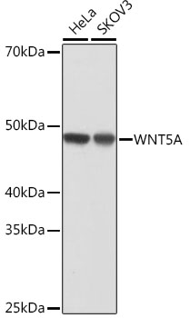 Western blot analysis of various lysates using WNT5A Rabbit mAb at 1:1000 dilution.|Secondary antibody: HRP-conjugated Goat anti-Rabbit IgG (H+L) at 1:10000 dilution.|Lysates/proteins: 25μg per lane.|Blocking buffer: 3% nonfat dry milk in TBST.|Detection: ECL Basic Kit.|Exposure time: 10s.