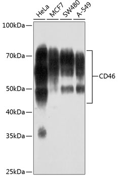 Western blot analysis of various lysates using CD46 Rabbit mAb at 1:1000 dilution.|Secondary antibody: HRP-conjugated Goat anti-Rabbit IgG (H+L) at 1:10000 dilution.|Lysates/proteins: 25μg per lane.|Blocking buffer: 3% nonfat dry milk in TBST.|Detection: ECL Basic Kit.|Exposure time: 3min.