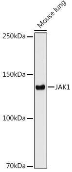 Western blot analysis of lysates from Mouse lung using JAK1 Rabbit mAb at 1:1000 dilution incubated overnight at 4℃.|Secondary antibody: HRP-conjugated Goat anti-Rabbit IgG (H+L) at 1:10000 dilution.|Lysates/proteins: 25μg per lane.|Blocking buffer: 3% nonfat dry milk in TBST.|Detection: ECL Enhanced Kit.|Exposure time: 180s.