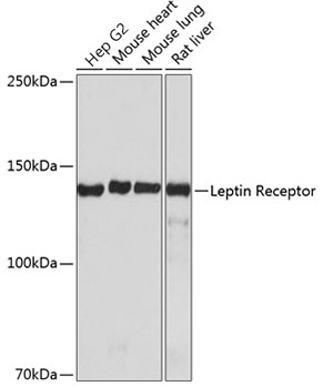 Western blot analysis of various lysates using Leptin Receptor Rabbit mAb at 1:1000 dilution.|Secondary antibody: HRP-conjugated Goat anti-Rabbit IgG (H+L) at 1:10000 dilution.|Lysates/proteins: 25μg per lane.|Blocking buffer: 3% nonfat dry milk in TBST.|Detection: ECL Basic Kit.|Exposure time: 1min .
