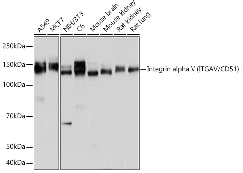 Western blot analysis of various lysates using Integrin alpha V (ITGAV/CD51) Rabbit mAb at 1:1000 dilution.|Secondary antibody: HRP-conjugated Goat anti-Rabbit IgG (H+L) at 1:10000 dilution.|Lysates/proteins: 25μg per lane.|Blocking buffer: 3% nonfat dry milk in TBST.|Detection: ECL Basic Kit.|Exposure time: 1s.