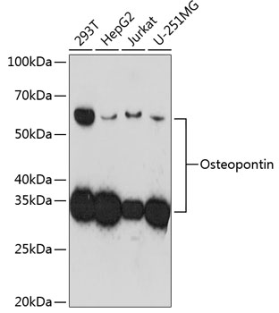 Western blot analysis of various lysates using Osteopontin Rabbit mAb at 1:1000 dilution incubated overnight at 4℃.|Secondary antibody: HRP-conjugated Goat anti-Rabbit IgG (H+L) at 1:10000 dilution.|Lysates/proteins: 25μg per lane.|Blocking buffer: 3% nonfat dry milk in TBST.|Detection: ECL Basic Kit.|Exposure time: 3min.