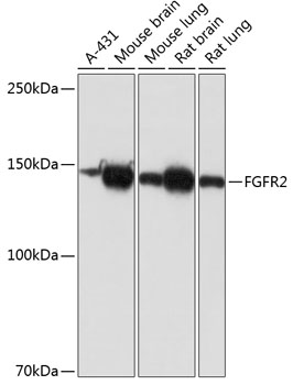 Western blot analysis of various lysates using [KO Validated] FGFR2 Rabbit mAb at 1:1000 dilution.|Secondary antibody: HRP-conjugated Goat anti-Rabbit IgG (H+L) at 1:10000 dilution.|Lysates/proteins: 25μg per lane.|Blocking buffer: 3% nonfat dry milk in TBST.|Detection: ECL Basic Kit.|Exposure time: 3min.