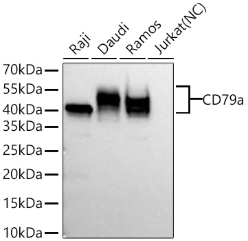 Western blot analysis of various lysates using CD79a Rabbit mAb at 1:5000 dilution incubated at room temperature for 1.5 hours.|Secondary antibody: HRP-conjugated Goat anti-Rabbit IgG (H+L) at 1:10000 dilution.|Lysates/proteins: 25 μg per lane.|Blocking buffer: 3% nonfat dry milk in TBST.|Detection: ECL Basic Kit.|Negative control (NC): Jurkat|Exposure time: 60s.