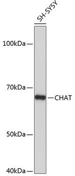 Western blot analysis of lysates from SH-SY5Y cells, using CHAT Rabbit mAb at 1:1000 dilution.|Secondary antibody: HRP-conjugated Goat anti-Rabbit IgG (H+L) at 1:10000 dilution.|Lysates/proteins: 25μg per lane.|Blocking buffer: 3% nonfat dry milk in TBST.|Detection: ECL Basic Kit.|Exposure time: 5s.