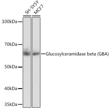 Western blot analysis of various lysates using Glucosylceramidase beta (GBA) Rabbit mAb at 1:1000 dilution.|Secondary antibody: HRP-conjugated Goat anti-Rabbit IgG (H+L) at 1:10000 dilution.|Lysates/proteins: 25μg per lane.|Blocking buffer: 3% nonfat dry milk in TBST.|Detection: ECL Basic Kit.|Exposure time: 10s.