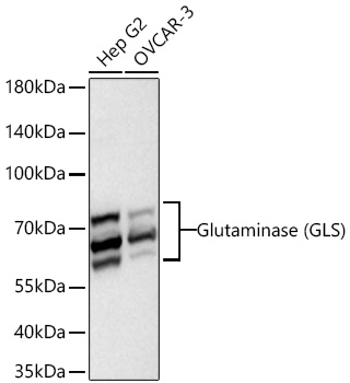 Western blot analysis of various lysates using Glutaminase (GLS) Rabbit mAb at 1:5000 dilution incubated at room temperature for 1.5 hours.|Secondary antibody: HRP-conjugated Goat anti-Rabbit IgG (H+L) at 1:10000 dilution.|Lysates/proteins: 25 μg per lane.|Blocking buffer: 3% nonfat dry milk in TBST.|Detection: ECL Basic Kit.|Exposure time: 20s.