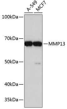 Western blot analysis of various lysates using MMP13 Rabbit mAb at 1:1000 dilution ncubated overnight at 4℃.|Secondary antibody: HRP-conjugated Goat anti-Rabbit IgG (H+L) at 1:10000 dilution.|Lysates/proteins: 25μg per lane.|Blocking buffer: 3% nonfat dry milk in TBST.|Detection: ECL Basic Kit.|Exposure time: 90s.