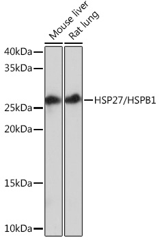 Western blot analysis of various lysates using HSP27/HSPB1Rabbit mAb at 1:1000 dilution.|Secondary antibody: HRP-conjugated Goat anti-Rabbit IgG (H+L) at 1:10000 dilution.|Lysates/proteins: 25μg per lane.|Blocking buffer: 3% nonfat dry milk in TBST.|Detection: ECL Basic Kit.|Exposure time: 30s.