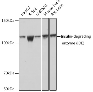 Western blot analysis of various lysates using Insulin-degrading enzyme (Insulin-degrading enzyme (IDE)) Rabbit mAb at 1：1000 dilution.|Secondary antibody: HRP-conjugated Goat anti-Rabbit IgG (H+L) at 1:10000 dilution.|Lysates/proteins: 25μg per lane.|Blocking buffer: 3% nonfat dry milk in TBST.|Detection: ECL Basic Kit.|Exposure time: 1s.