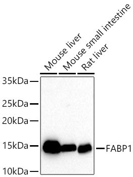 Western blot analysis of various lysates using FABP1 Rabbit mAb at 1:1000 dilution incubated at room temperature for 1.5 hours.|Secondary antibody: HRP-conjugated Goat anti-Rabbit IgG (H+L) at 1:10000 dilution.|Lysates/proteins: 25 μg per lane.|Blocking buffer: 3% nonfat dry milk in TBST.|Detection: ECL Basic Kit.|Exposure time: 30s.