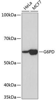 Western blot analysis of various lysates using G6PD Rabbit mAb at 1:1000 dilution.|Secondary antibody: HRP-conjugated Goat anti-Rabbit IgG (H+L) at 1:10000 dilution.|Lysates/proteins: 25μg  per lane.|Blocking buffer: 3% nonfat dry milk in TBST.|Detection: ECL Basic Kit.|Exposure time: 5s.