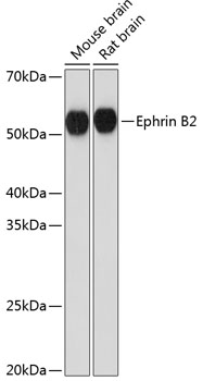 Western blot analysis of various lysates using Ephrin B2 Rabbit mAb at 1:1000 dilution.|Secondary antibody: HRP-conjugated Goat anti-Rabbit IgG (H+L) at 1:10000 dilution.|Lysates/proteins: 25μg per lane.|Blocking buffer: 3% nonfat dry milk in TBST.|Detection: ECL Basic Kit.|Exposure time: 5s.