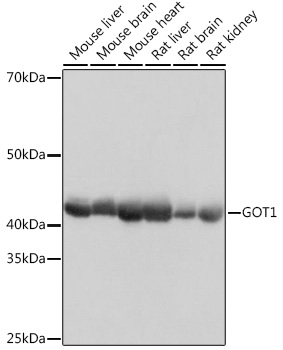 Western blot analysis of various lysates using GOT1  Rabbit mAb at 1：1000 dilution.|Secondary antibody: HRP-conjugated Goat anti-Rabbit IgG (H+L) at 1:10000 dilution.|Lysates/proteins: 25μg per lane.|Blocking buffer: 3% nonfat dry milk in TBST.|Detection: ECL Basic Kit.|Exposure time: 1s.
