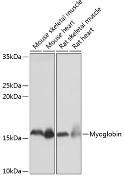 Western blot analysis of various lysates using Myoglobin Rabbit mAb at 1：1000 dilution.|Secondary antibody: HRP-conjugated Goat anti-Rabbit IgG (H+L) at 1:10000 dilution.|Lysates/proteins: 25μg per lane.|Blocking buffer: 3% nonfat dry milk in TBST.|Detection: ECL Basic Kit.|Exposure time: 1s.