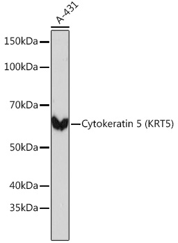 Western blot analysis of lysates from A-431 cells, using Cytokeratin 5 Rabbit mAb at 1：1000 dilution.|Secondary antibody: HRP-conjugated Goat anti-Rabbit IgG (H+L) at 1:10000 dilution.|Lysates/proteins: 25μg per lane.|Blocking buffer: 3% nonfat dry milk in TBST.|Detection: ECL Basic Kit.|Exposure time: 3s.
