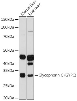 Western blot analysis of various lysates using Glycophorin C (GYPC) Rabbit mAb at 1:1000 dilution.|Secondary antibody: HRP-conjugated Goat anti-Rabbit IgG (H+L) at 1:10000 dilution.|Lysates/proteins: 25μg per lane.|Blocking buffer: 3% nonfat dry milk in TBST.|Detection: ECL Basic Kit.|Exposure time: 30s.