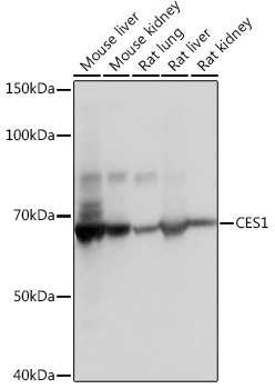 Western blot analysis of various lysates using CES1 Rabbit mAb at 1：1000 dilution.|Secondary antibody: HRP-conjugated Goat anti-Rabbit IgG (H+L) at 1:10000 dilution.|Lysates/proteins: 25μg per lane.|Blocking buffer: 3% nonfat dry milk in TBST.|Detection: ECL Basic Kit.|Exposure time: 1s.