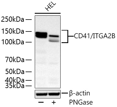 Western blot analysis of various lysates using CD41/ITGA2B Rabbit mAb at 1:5000 dilution incubated overnight at 4℃. HEL cells treated with PNGase (2 μL) at 37℃ for 1 hours.|Secondary antibody: HRP-conjugated Goat anti-Rabbit IgG (H+L) at 1:10000 dilution.|Lysates/proteins: 30 μg per lane.|Blocking buffer: 3% nonfat dry milk in TBST.|Detection: ECL Basic Kit.|Exposure time: 90 s.