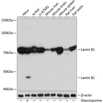 Western blot analysis of various lysates using Lamin B1 Rabbit mAb at 1：1000 dilution.|Secondary antibody: HRP-conjugated Goat anti-Rabbit IgG (H+L) at 1:10000 dilution.|Lysates/proteins: 25μg per lane.|Blocking buffer: 3% nonfat dry milk in TBST.|Detection: ECL Basic Kit.|Exposure time: 10s.