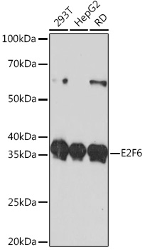 Western blot analysis of various lysates using E2F6 Rabbit mAb at 1:1000 dilution.|Secondary antibody: HRP-conjugated Goat anti-Rabbit IgG (H+L) at 1:10000 dilution.|Lysates/proteins: 25μg per lane.|Blocking buffer: 3% nonfat dry milk in TBST.|Detection: ECL Basic Kit.|Exposure time: 90s.