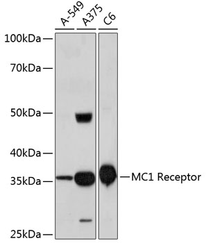 Western blot analysis of various lysates using MC1 Receptor Rabbit mAb at 1：1000 dilution.|Secondary antibody: HRP-conjugated Goat anti-Rabbit IgG (H+L) at 1:10000 dilution.|Lysates/proteins: 25μg per lane.|Blocking buffer: 3% nonfat dry milk in TBST.|Detection: ECL Basic Kit.|Exposure time: 3min.