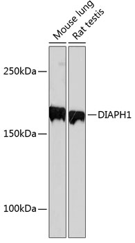 Western blot analysis of various lysates using DIAPH1 Rabbit mAb at 1：1000 dilution incubated overnight at 4℃..|Secondary antibody: HRP-conjugated Goat anti-Rabbit IgG (H+L) at 1:10000 dilution.|Lysates/proteins: 25 μg per lane.|Blocking buffer: 3% nonfat dry milk in TBST.|Detection: ECL Basic Kit.|Exposure time: 90 s.