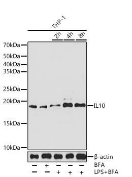Western blot analysis of various lysates using IL10 Rabbit mAb at 1:1000 dilution incubated overnight at 4°C. THP-1 cells were treated with LPS (100ng/ml) and Brefeldin A (300ng/ml) for different times of stimulation.|Secondary antibody: HRP-conjugated Goat anti-Rabbit IgG (H+L) at 1:10000 dilution.|Lysates/proteins: 25μg per lane.|Blocking buffer: 3% nonfat dry milk in TBST.|Detection: ECL Basic Kit.|Exposure time: 90s.