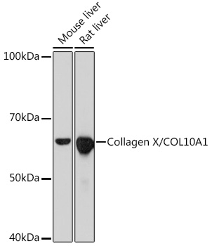 Western blot analysis of various lysates using Collagen X/COL10A1 Rabbit mAb at 1:1000 dilution.|Secondary antibody: HRP-conjugated Goat anti-Rabbit IgG (H+L) at 1:10000 dilution.|Lysates/proteins: 25μg per lane.|Blocking buffer: 3% nonfat dry milk in TBST.|Detection: ECL Basic Kit.|Exposure time: 10s.