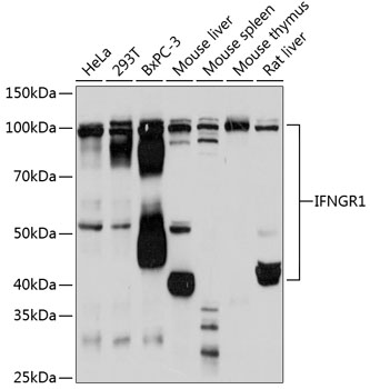 Western blot analysis of various lysates using IFNGR1 Rabbit mAb at 1:1000 dilution.|Secondary antibody: HRP-conjugated Goat anti-Rabbit IgG (H+L) at 1:10000 dilution.|Lysates/proteins: 25μg per lane.|Blocking buffer: 3% nonfat dry milk in TBST.|Detection: ECL Basic Kit.|Exposure time: 30s.