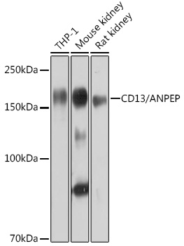 Western blot analysis of various lysates using CD13/ANPEP Rabbit mAb at 1:1000 dilution.|Secondary antibody: HRP-conjugated Goat anti-Rabbit IgG (H+L) at 1:10000 dilution.|Lysates/proteins: 25μg per lane.|Blocking buffer: 3% nonfat dry milk in TBST.|Detection: ECL Basic Kit.|Exposure time: 10s.
