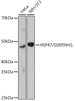 Western blot analysis of various lysates using HSP47/SERPINH1 Rabbit mAb at 1:1000 dilution.|Secondary antibody: HRP-conjugated Goat anti-Rabbit IgG (H+L) at 1:10000 dilution.|Lysates/proteins: 25μg per lane.|Blocking buffer: 3% nonfat dry milk in TBST.|Detection: ECL Basic Kit.|Exposure time: 3min.