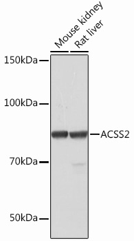 Western blot analysis of various lysates using ACSS2 Rabbit mAb at 1：1000 dilution.|Secondary antibody: HRP-conjugated Goat anti-Rabbit IgG (H+L) at 1:10000 dilution.|Lysates/proteins: 25μg per lane.|Blocking buffer: 3% nonfat dry milk in TBST.|Detection: ECL Basic Kit.|Exposure time: 60s.