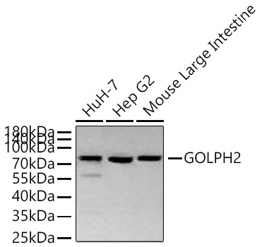 Western blot analysis of various lysates using GOLPH2 Rabbit mAb at 1:1000 dilution incubated overnight at 4℃.|Secondary antibody: HRP-conjugated Goat anti-Rabbit IgG (H+L) at 1:10000 dilution.|Lysates/proteins: 25 μg per lane.|Blocking buffer: 3% nonfat dry milk in TBST.|Detection: ECL Basic Kit.|Exposure time: 90 s.