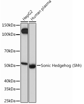 Western blot analysis of various lysates using Sonic Hedgehog (Shh) Rabbit mAb at 1:1000 dilution.|Secondary antibody: HRP-conjugated Goat anti-Rabbit IgG (H+L) at 1:10000 dilution.|Lysates/proteins: 25μg per lane.|Blocking buffer: 3% nonfat dry milk in TBST.|Detection: ECL Basic Kit.|Exposure time: 60s.