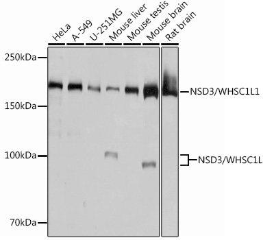 Western blot analysis of various lysates using NSD3/WHSC1L1 Rabbit mAb at 1：1000 dilution.|Secondary antibody: HRP-conjugated Goat anti-Rabbit IgG (H+L) at 1:10000 dilution.|Lysates/proteins: 25μg per lane.|Blocking buffer: 3% nonfat dry milk in TBST.|Detection: ECL Basic Kit.|Exposure time: 3s.
