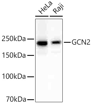 Western blot analysis of various lysates using GCN2 Rabbit mAb at 1:1000 dilution incubated overnight at 4℃.|Secondary antibody: HRP-conjugated Goat anti-Rabbit IgG (H+L) at 1:10000 dilution.|Lysates/proteins: 25 μg per lane.|Blocking buffer: 3% nonfat dry milk in TBST.|Detection: ECL Basic Kit.|Exposure time: 60 s.