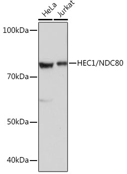 Western blot analysis of various lysates using HEC1/NDC80 Rabbit mAb at 1:1000 dilution. |Secondary antibody: HRP-conjugated Goat anti-Rabbit IgG (H+L) at 1:10000 dilution.|Lysates/proteins: 25 μg per lane.|Blocking buffer: 3% nonfat dry milk in TBST.|Detection: ECL Basic Kit.|Exposure time: 3 s.
