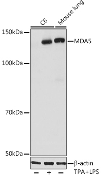 Western blot analysis of various lysates using MDA5 Rabbit mAb at 1:1000 dilution. C6 cells were treated with LPS for 6 hours and TPA for 3 hours of stimulation.|Secondary antibody: HRP-conjugated Goat anti-Rabbit IgG (H+L) at 1:10000 dilution.|Lysates/proteins: 25μg per lane.|Blocking buffer: 3% nonfat dry milk in TBST.|Detection: ECL Basic Kit.|Exposure time: 10s.