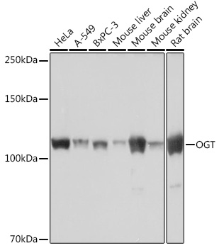 Western blot analysis of various lysates using OGT Rabbit mAb at 1：1000 dilution.|Secondary antibody: HRP-conjugated Goat anti-Rabbit IgG (H+L) at 1:10000 dilution.|Lysates/proteins: 25μg per lane.|Blocking buffer: 3% nonfat dry milk in TBST.|Detection: ECL Basic Kit.|Exposure time: 10s.