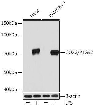 Western blot analysis of various lysates using COX2/PTGS2 Rabbit mAb at 1:1000 dilution.|Secondary antibody: HRP-conjugated Goat anti-Rabbit IgG (H+L) at 1:10000 dilution.|Lysates/proteins: 25μg per lane.|Blocking buffer: 3% nonfat dry milk in TBST.|Detection: ECL Basic Kit.|Exposure time: 10s.