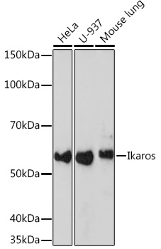 Western blot analysis of various lysates using Ikaros Rabbit mAb at 1:1000 dilution.|Secondary antibody: HRP-conjugated Goat anti-Rabbit IgG (H+L) at 1:10000 dilution.|Lysates/proteins: 25μg per lane.|Blocking buffer: 3% nonfat dry milk in TBST.|Detection: ECL Basic Kit.|Exposure time: 3min.
